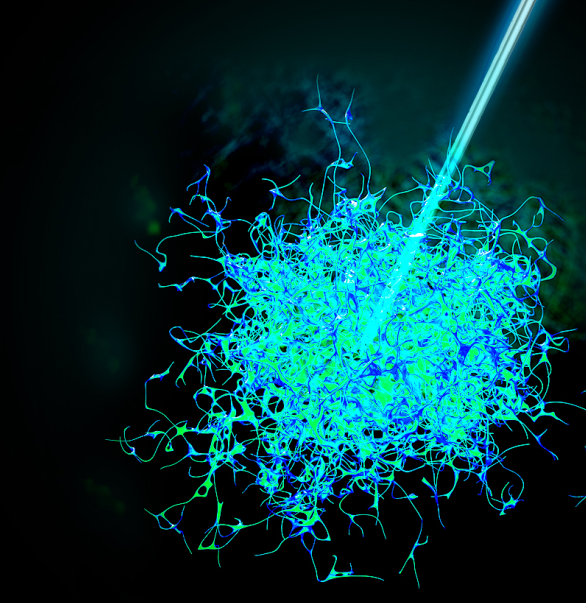 今天，我們把腫瘤的內(nèi)部「融穿」了