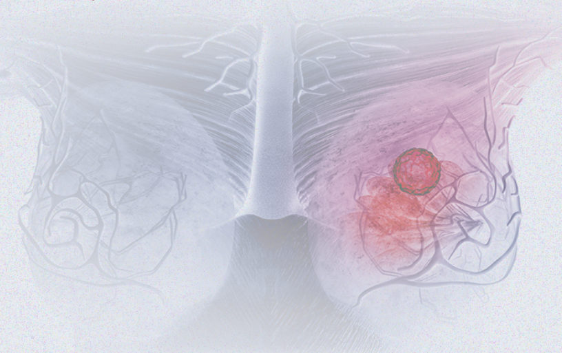 國(guó)際婦女節(jié) | 關(guān)注乳腺癌 微創(chuàng)介入讓美麗繼續(xù)，「乳」愿以償正成為現(xiàn)實(shí)