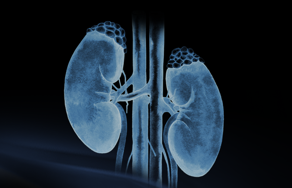 世界腎臟日 | 相得「腎」歡，融有術(shù)、精準(zhǔn)適形