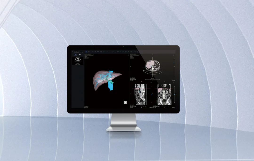 北京市首款！海杰亞醫(yī)療自主研發(fā)的AI+肝臟CT影像處理軟件獲批上市！